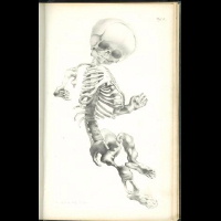 <b>Rittershain</b> Pathologie und Therapie der Rachitis 1863